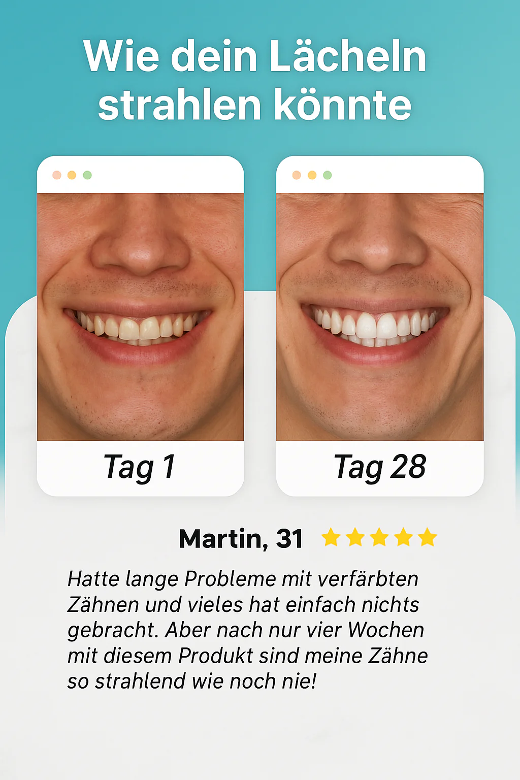 Volairo Elektrische Zahnbürste