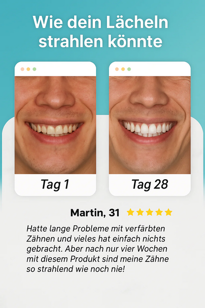 Volairo Elektrische Zahnbürste